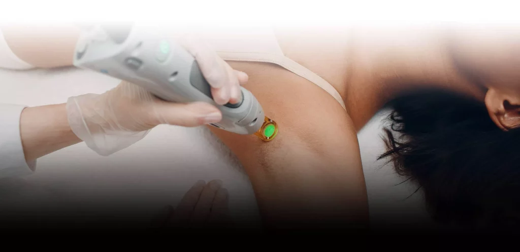 Salon Épilsoft équipé pour l'épilation laser.