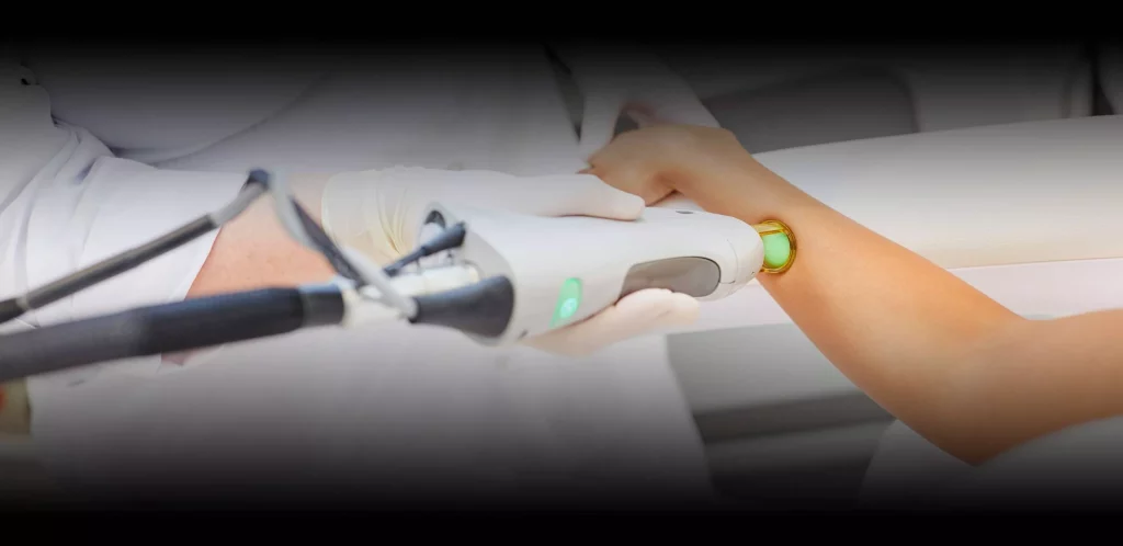 Femme lors d'une séance d'épilation laser avec Épilsoft.