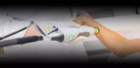 Femme lors d'une séance d'épilation laser avec Épilsoft.