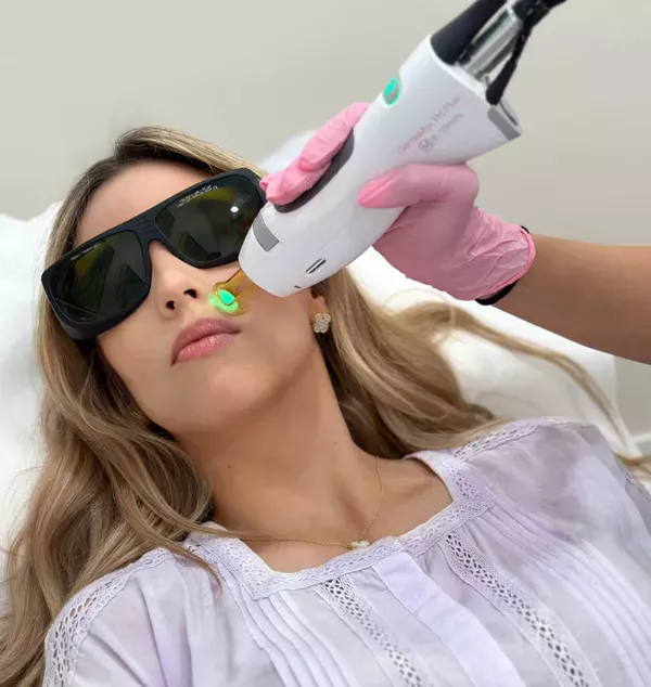 Praticienne réalisant une épilation laser du visage avec un laser ND:YAG, adapté aux peaux foncées et sensibles.