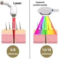 Différence entre l’épilation à la lumière pulsée (IPL) et l’épilation laser chez Epilsoft.