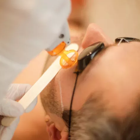 Résultats avant/après d’une épilation laser réussie.