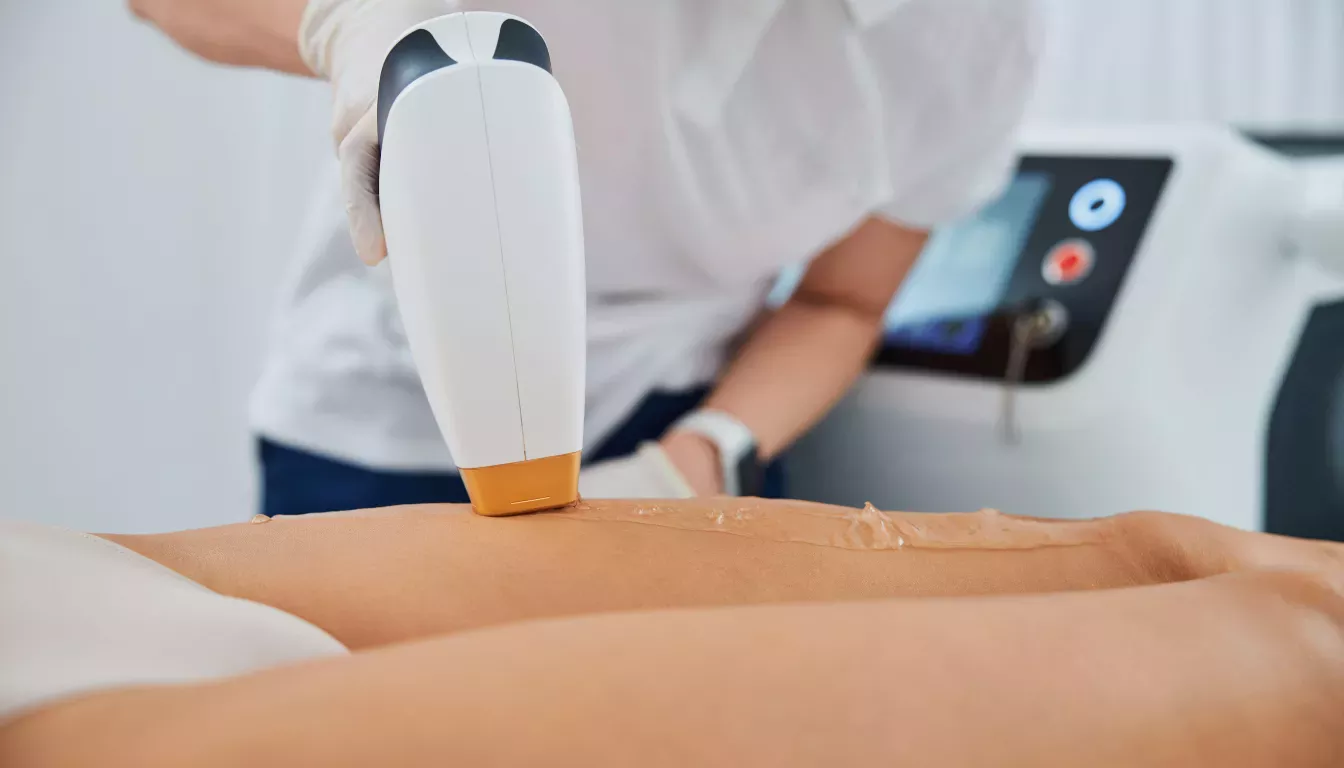 Aesthetic Diode laser hair removal