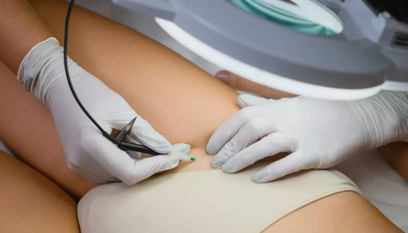Electric hair removal (Electrolysis)